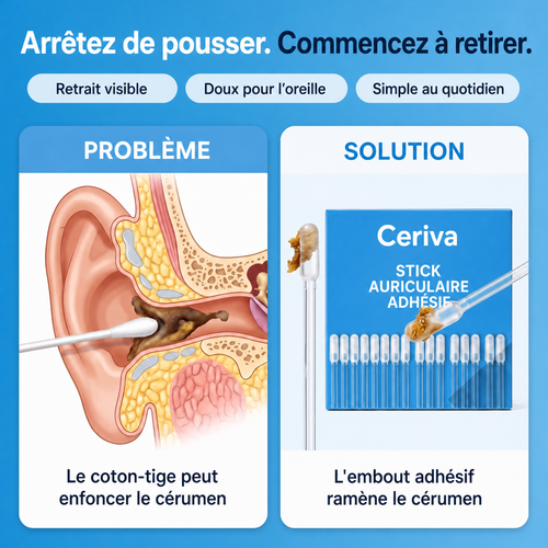 Cure-Oreilles Nouvelle Génération | Ceriva