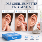 Cure-Oreilles Nouvelle Génération | Ceriva